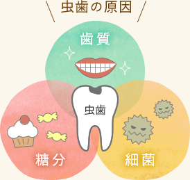 虫歯の原因は「歯質」「糖分」「最近」