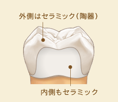 外側はセラミック（陶器）、内側もセラミック